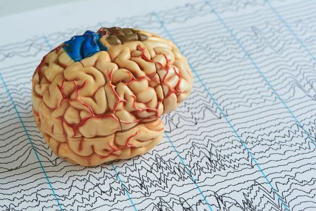 Polissonografia: para que serve e quando fazer? 23 epilepsia