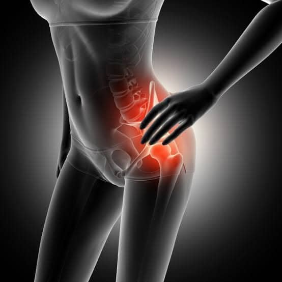 Síndrome do Piriforme: Como Aliviar a Dor e Prevenir Recorrências 1 img 2140 - abril 2025