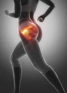 Neuro-Oncologia 22 dor-do-quadril